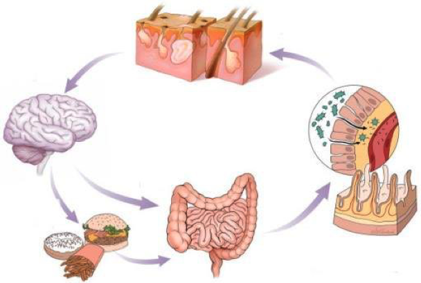 cervello-intestino-pelle